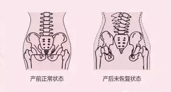 重慶六合學校帶您認識產后修復的幾大誤區