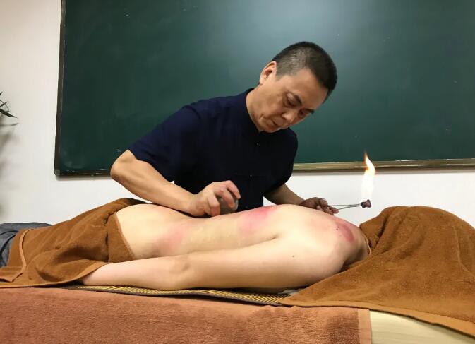 康復理療培訓學校分享火罐和氣罐的區別