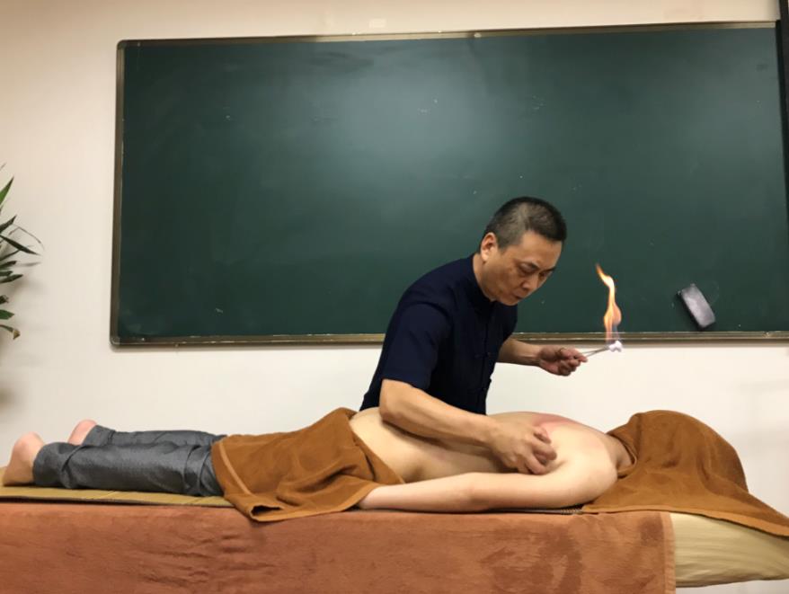 中醫(yī)可以通過(guò)拔罐辨別體質(zhì)