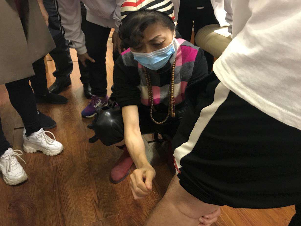 針灸能治療風濕性關節炎嗎？