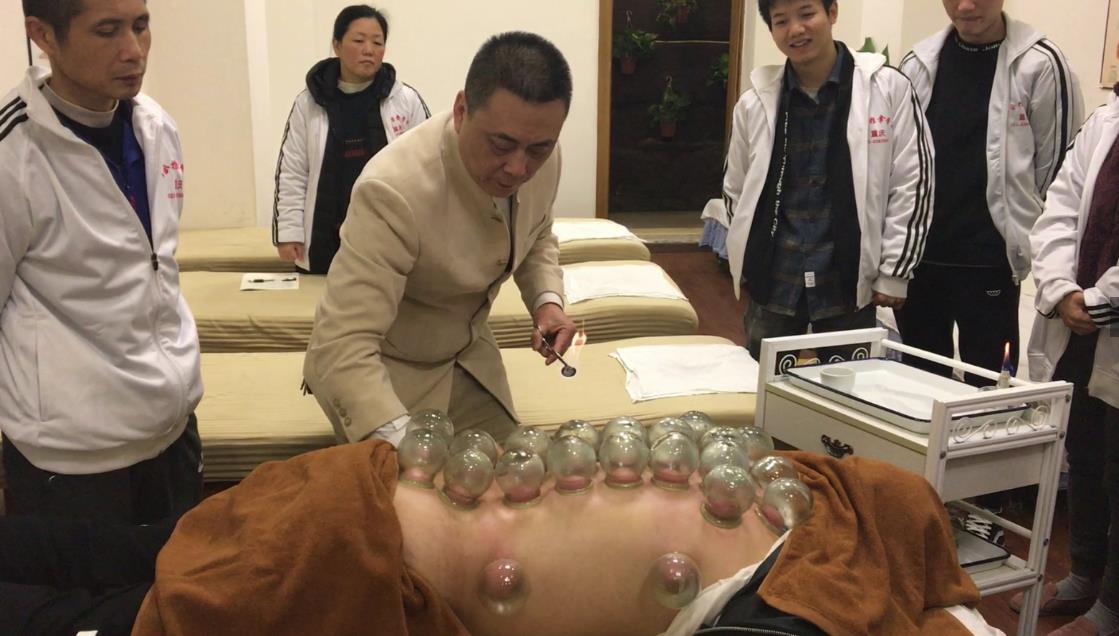 中醫(yī)拔罐治腰痛，來看看這三種腰痛的拔罐方法